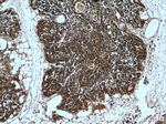 KDM4D Antibody in Immunohistochemistry (Paraffin) (IHC (P))