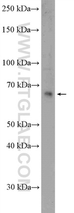 KDM4D Antibody in Western Blot (WB)