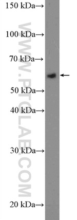 KDM4D Antibody in Western Blot (WB)