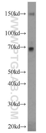 FNDC3B Antibody in Western Blot (WB)