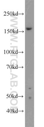 ZZZ3 Antibody in Western Blot (WB)