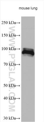 PDE5A Antibody in Western Blot (WB)