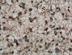 C9orf72 Antibody in Immunohistochemistry (Paraffin) (IHC (P))