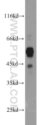 C9orf72 Antibody in Western Blot (WB)