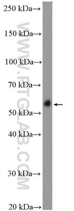 C9orf72 Antibody in Western Blot (WB)