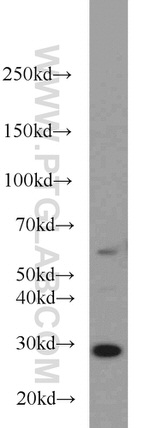 C9orf72 Antibody in Western Blot (WB)