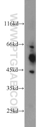 C9orf72 Antibody in Western Blot (WB)