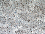 CCAR2 Antibody in Immunohistochemistry (Paraffin) (IHC (P))