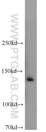 CCAR2 Antibody in Western Blot (WB)