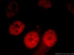 CCAR2 Antibody in Immunocytochemistry (ICC/IF)