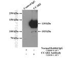 CCAR2 Antibody in Immunoprecipitation (IP)