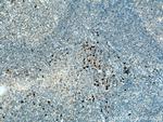 IL-28A Antibody in Immunohistochemistry (Paraffin) (IHC (P))