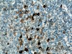 IL-28A Antibody in Immunohistochemistry (Paraffin) (IHC (P))