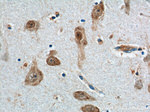 A2BP1 Antibody in Immunohistochemistry (Paraffin) (IHC (P))