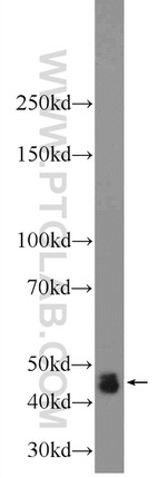 DNASE2B Antibody in Western Blot (WB)