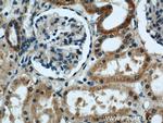 EYA1 Antibody in Immunohistochemistry (Paraffin) (IHC (P))