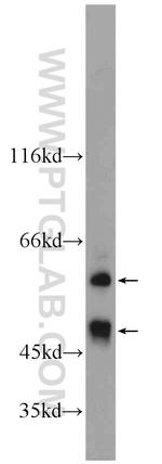 EYA1 Antibody in Western Blot (WB)