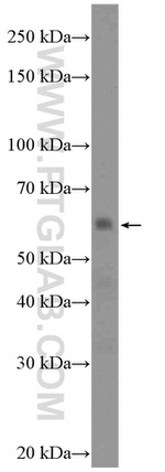 EYA1 Antibody in Western Blot (WB)