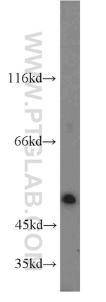 C14orf39 Antibody in Western Blot (WB)