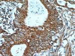 A4GNT Antibody in Immunohistochemistry (Paraffin) (IHC (P))