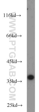 A4GNT Antibody in Western Blot (WB)