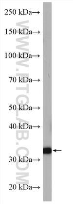 A4GNT Antibody in Western Blot (WB)