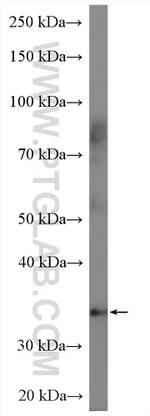 A4GNT Antibody in Western Blot (WB)