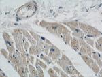 STARS/ABRA Antibody in Immunohistochemistry (Paraffin) (IHC (P))