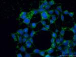 RBP1 Antibody in Immunocytochemistry (ICC/IF)