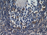 RBP1 Antibody in Immunohistochemistry (Paraffin) (IHC (P))