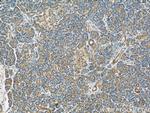 RBP1 Antibody in Immunohistochemistry (Paraffin) (IHC (P))