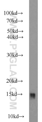 RBP1 Antibody in Western Blot (WB)