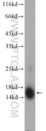 RBP1 Antibody in Western Blot (WB)