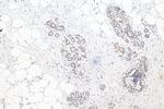 WHSC1 Antibody in Immunohistochemistry (Paraffin) (IHC (P))