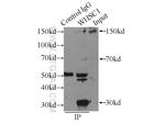 WHSC1 Antibody in Immunoprecipitation (IP)