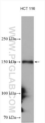 WHSC1 Antibody in Western Blot (WB)
