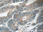 ARK5 Antibody in Immunohistochemistry (Paraffin) (IHC (P))