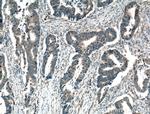 ARK5 Antibody in Immunohistochemistry (Paraffin) (IHC (P))