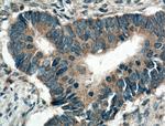 ARK5 Antibody in Immunohistochemistry (Paraffin) (IHC (P))