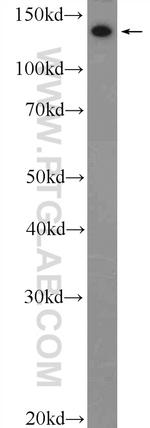 Collagen Type III (N-terminal) Antibody in Western Blot (WB)