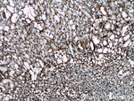 Collagen Type III (N-terminal) Antibody in Immunohistochemistry (Paraffin) (IHC (P))