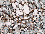 Collagen Type III (N-terminal) Antibody in Immunohistochemistry (Paraffin) (IHC (P))