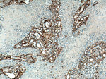 Collagen Type III (N-terminal) Antibody in Immunohistochemistry (Paraffin) (IHC (P))