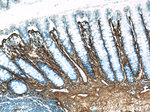 Collagen Type III (N-terminal) Antibody in Immunohistochemistry (Paraffin) (IHC (P))