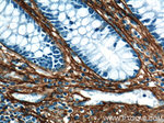 Collagen Type III (N-terminal) Antibody in Immunohistochemistry (Paraffin) (IHC (P))