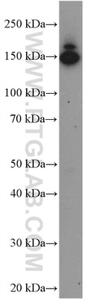 Collagen Type III (N-terminal) Antibody in Western Blot (WB)