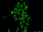 MIXL1 Antibody in Immunocytochemistry (ICC/IF)