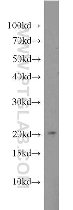 MIXL1 Antibody in Western Blot (WB)