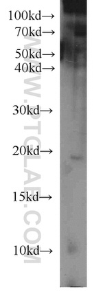 MIXL1 Antibody in Western Blot (WB)