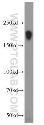 LIFR Antibody in Western Blot (WB)